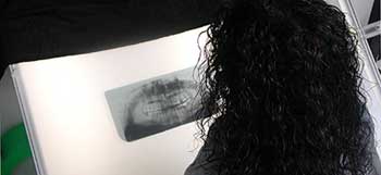 "Selda" ser på røntgenbilde av hennes egen kjeve. Bildet ble brukt for å fastslå hennnes alder.