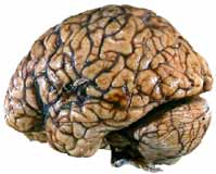 Hjernen før inngrepet: Stygg og fæl