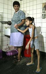 En mor hjelper sin 10 år gamle feilernærte datter, Pamela (foto: Reuters/Enrique Marcarian). 