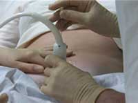 Fostervannsprøven er ganske farlig. 1 av 100 fostre aborteres på grunn av selve prøven. 