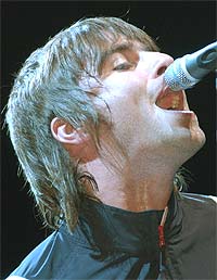 Oasis-vokalist Liam Gallagher får en stor tannlegeregning. Foto: Sebastian Artz / Getty Images.