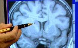 Ved hjelp av den nye teknikken kan et MR-bilde av hjernen gi mer informasjon enn før.