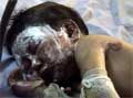 Skadet barn på sykehus i Bagdad. (Reuters)