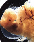 24 dager gammelt embryo med frynsete utløpere fast til livmoren