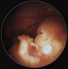 Sju uker gammelt embryo er snart klar for å sutte på tommeltotten!
