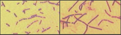 Til venstre deler bakteriene seg uten penicillin. Til høyre får ikke bakteriene delt seg når penicillinet virker.