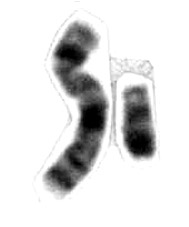 X-kromosomet til venstre og Y-kromosomet til høyre.