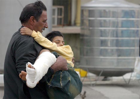 En irakisk far lper med sin srede snn til sykehuset. Foto: AFP/Reuters