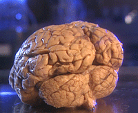 Ligger sjela overhodet i hjernen? Foto: NRK