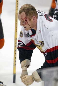 Ottawa Senators Rob går blødende av isen etter masseslagsmålet. (Foto: AP/Scanpix)