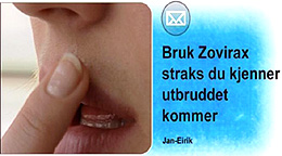 Zovirax hjelper godt mot munnsår. Smør på salven straks du får et utbrudd. Foto: NRK Puls