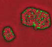 MRSA-bakterie. Copyright: Cellsalive.com