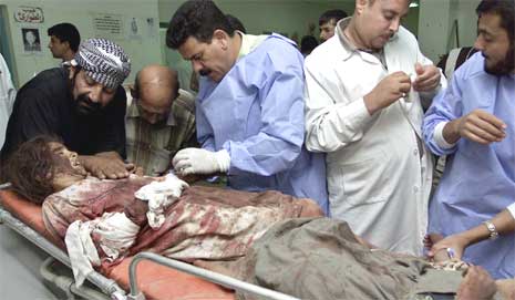 En skadd irakisk jente blir behandlet på sykehuset i Falluja i dag. (Foto: Reuters/Scanpix)