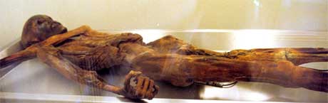 Ötzi (Foto: Scanpix AP)