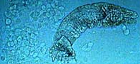 Lakseparasitten Gyrodaktylus salaris er mange redde for. Foto: NRK