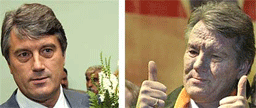 Viktor Justsjenko før og nå (til høyre) foto: AP/Scanpix 