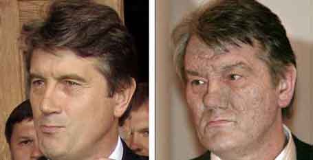 UKRAINA: Viktor Jusjtsjenko før og etter. Scanpix)