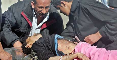 En mann som ble sret i et av angrepene fredag, fr behandling ved Yarmouk-sykehuset. (Foto: Scanpix / Reuters / Faleh Kheiber)