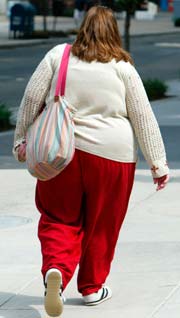 Mer enn 20.000 nordmenn lider av sykelig overvekt. Foto: Scanpix