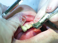 Kvinner går oftere til tannlegen enn menn. (Foto: Lise Åserud, Scanpix)