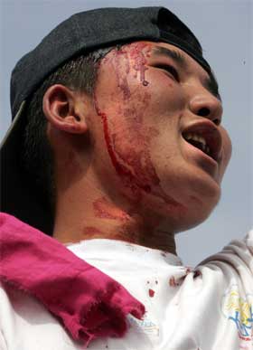 En skadd demonstrant i dagens kamper. (Foto: Scanpix / AFP) En skadd demonstrant i dagens kamper. (Foto: Scanpix / AFP)