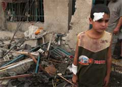 En liten gutt står skadet i en av Bagdads gater (Foto: Scanpix/AP/H. Mizban