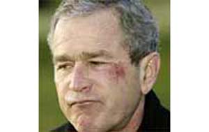  2002: Bush forklarer skrubbsårene i ansiktet med at han satte en saltkringle fast i halsen, besvimte, og slo hodet i bordplaten. (ekte)