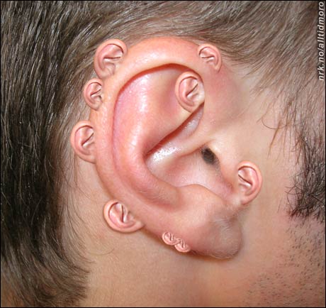 Folk som rammes av såkalt "multippelt øre-syndrom" er vant til uønsket oppmerksomhet. Til gjengjeld har de bedre hørsel enn andre. (Alltid Moro)