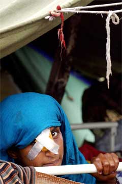 Denne skadde jenta har iallefall tak over hovudet. (Foto: AFP/Scanpix)