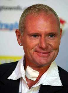 Paul Gascoigne. Plasterlappen på halsen kommer av et mindre inngrep. (Foto: AP Photo/PA, Rui Vieira) Paul Gascoigne. Plasterlappen på halsen kommer av et mindre inngrep. (Foto: AP Photo/PA, Rui Vieira)