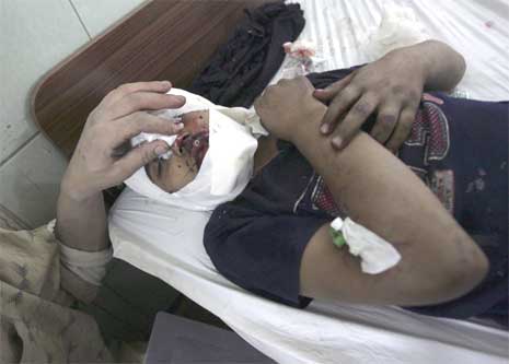 Et av bombeofrene på sykehus i Bagdad etter bilbomben. (Foto: Reuters/Scanpix)