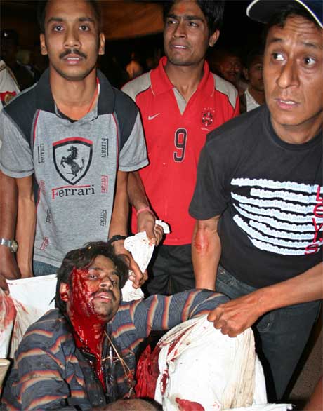 Ein skadd mann blir teken hand om etter eksplosjonen i eit hindutempel i Varanasi i India. (Foto: AP/Scanpix)