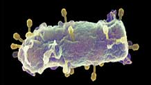 E.coli-bakterie (Arkivfoto) 