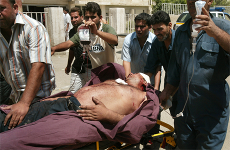 En skadet mann blir brakt til sykehus etter at en selvmordsbomber drepte 13 personer og skadet flere i Irak 26 mai. (Foto: AP, Scanpix)