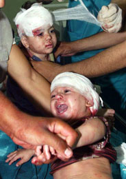 Helsepersonell behandler to sårede babyer etter rakettangrepet (Scanpix/Reuters)