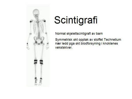 Foto: Klinikk for bildediagnostikk ved St. Olavs Hospital. 